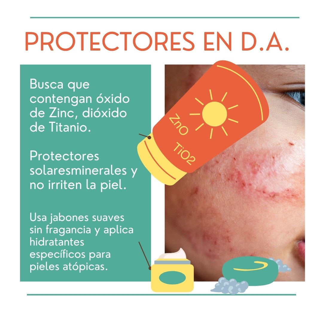 Cuidando la piel con protección solar Dermatitis atópica