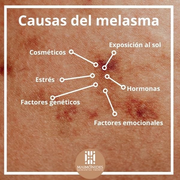 Causas del Melasma: El Enigma de las Manchas en la Piel