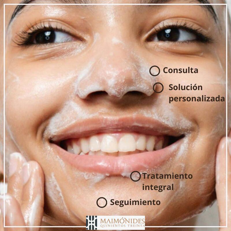 tratamiento-dermatologico-para-acne-cdmx