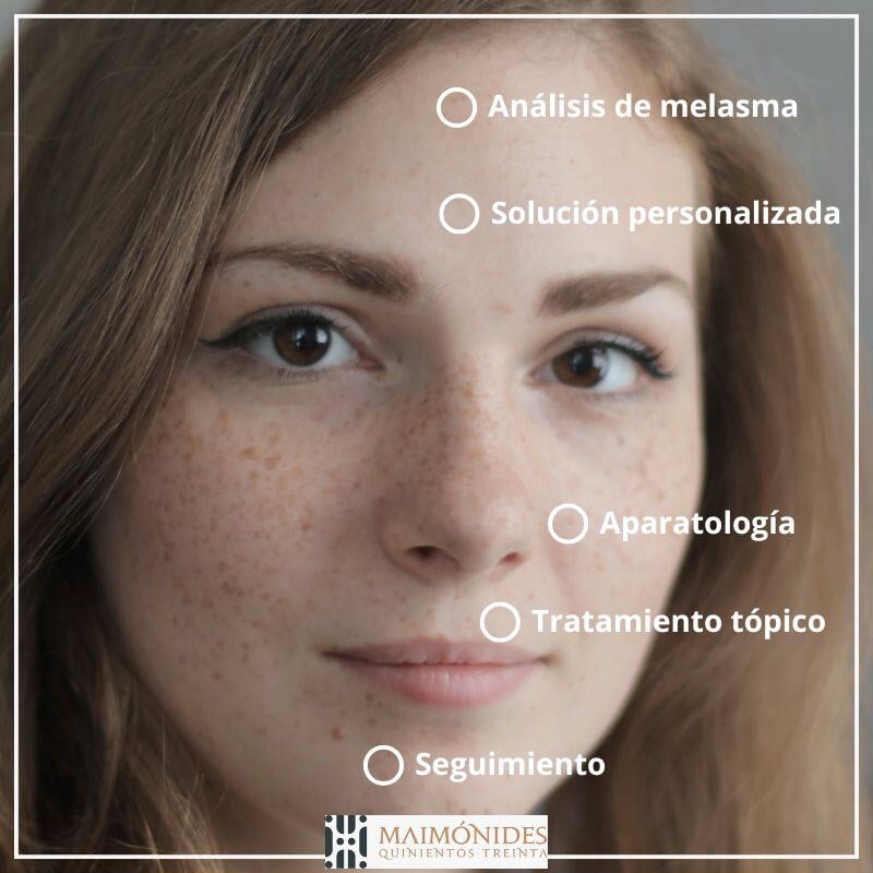 tratamiento-dermatologico-para-melasma-cdmx